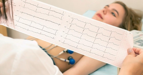 Entenda o seu eletrocardiograma (ECG)